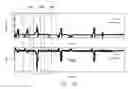 Fig. 89 - SENSOR SYSTEMS, DEVICES, AND METHODS FOR CONTINUOUS GLUCOSE MONITORING