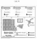Fig. 04 - Microtentacle imaging in patient tumor samples