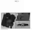 Fig. 08 - Microtentacle imaging in patient tumor samples