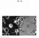 Fig. 11 - Microtentacle imaging in patient tumor samples