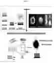 Fig. 15 - Microtentacle imaging in patient tumor samples