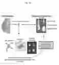 Fig. 17 - Microtentacle imaging in patient tumor samples
