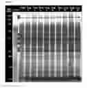 Fig. 02 - Proteomics based diagnostic detection method for chronic sinusitis