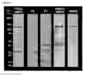 Fig. 03 - Proteomics based diagnostic detection method for chronic sinusitis