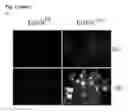 Fig. 06 - Personalized therapy of inflammation-associated cancer using methods of assessing the susceptibility of a subject to the treatment with EGFR inhibitors/antagonists