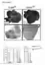 Fig. 09 - Personalized therapy of inflammation-associated cancer using methods of assessing the susceptibility of a subject to the treatment with EGFR inhibitors/antagonists