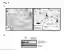 Fig. 13 - Personalized therapy of inflammation-associated cancer using methods of assessing the susceptibility of a subject to the treatment with EGFR inhibitors/antagonists