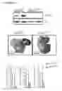 Fig. 17 - Personalized therapy of inflammation-associated cancer using methods of assessing the susceptibility of a subject to the treatment with EGFR inhibitors/antagonists