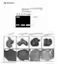 Fig. 19 - Personalized therapy of inflammation-associated cancer using methods of assessing the susceptibility of a subject to the treatment with EGFR inhibitors/antagonists