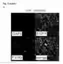 Fig. 22 - Personalized therapy of inflammation-associated cancer using methods of assessing the susceptibility of a subject to the treatment with EGFR inhibitors/antagonists