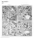 Fig. 26 - Personalized therapy of inflammation-associated cancer using methods of assessing the susceptibility of a subject to the treatment with EGFR inhibitors/antagonists