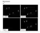 Fig. 30 - Personalized therapy of inflammation-associated cancer using methods of assessing the susceptibility of a subject to the treatment with EGFR inhibitors/antagonists