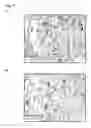 Fig. 31 - Personalized therapy of inflammation-associated cancer using methods of assessing the susceptibility of a subject to the treatment with EGFR inhibitors/antagonists
