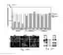 Fig. 12 - CANCER BIOMARKERS AND METHODS OF USE THEREOF