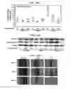 Fig. 43 - CANCER BIOMARKERS AND METHODS OF USE THEREOF