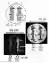 Fig. 15 - Universal, modular temperature controlled MRI phantom for calibrated anisotropic and isotropic imaging including hollow fluid filled tubular textiles for calibrated anisotropic imaging