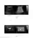 Fig. 06 - Clustering, noise reduction and visualization method for doppler ultrasound images