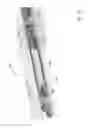 Fig. 04 - Gamma detector protection for downhole operations