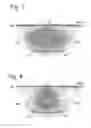Fig. 03 - Method and apparatus for directional designature