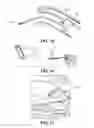 Fig. 09 - Attachment for head mounted display