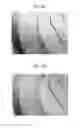 Fig. 08 - Backlight unit and autostereoscopic 3D display device including the same