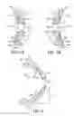 Fig. 04 - Eyewear having a flexural member