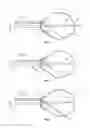 Fig. 02 - Apparatus and methods for controlling axial growth with an ocular lens