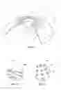 Fig. 07 - Apparatus and methods for controlling axial growth with an ocular lens