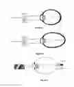 Fig. 02 - Corneal remodelling contact lenses and methods of treating refractive error using corneal remodelling