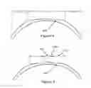 Fig. 03 - Corneal remodelling contact lenses and methods of treating refractive error using corneal remodelling