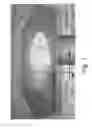 Fig. 05 - Adaptive photothermal lens