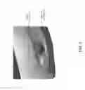 Fig. 04 - Electronic device