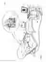 Fig. 02 - Global mapping catheter contact optimization