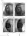 Fig. 07 - Apparatus and method for acquiring iris image outdoors and indoors