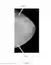 Fig. 15 - Image reconstruction system and method