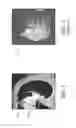 Fig. 02 - Visualization of tissue of interest in contrast-enhanced image data