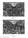 Fig. 04 - METHOD AND ELECTRONIC DEVICE FOR IMPLEMENTING PAGE SCROLLING SPECIAL EFFECT