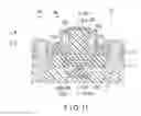 Fig. 10 - OPERATION INPUT UNIT AND ENERGY TREATMENT INSTRUMENT