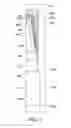 Fig. 06 - CHIP PACKAGE AND METHOD FOR FORMING THE SAME
