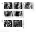 Fig. 07 - Functionalized nanostructures and devices including photovoltaic devices