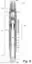 Fig. 07 - Electric submersible pump power cable termination assembly