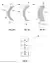 Fig. 06 - Electric machine, method of manufacturing the electric machine, rotor and adjustment device
