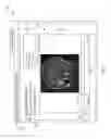 Fig. 04 - Remote cine viewing of medical images on a zero-client application