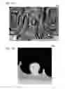 Fig. 08 - Medical imaging processing apparatus for a virtual endoscope image