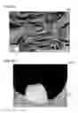 Fig. 09 - Medical imaging processing apparatus for a virtual endoscope image