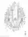Fig. 05 - Replacement part unit for plasma torch, electrode, insulating guide, and nozzle