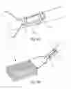 Fig. 07 - Lawn debris blower bagging system