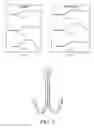 Fig. 03 - Flared double fish hook