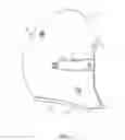 Fig. 02 - Headgear configured for positioning of spectacles