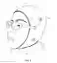 Fig. 08 - Headgear configured for positioning of spectacles